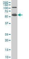 Anti-IRF5 Antibody