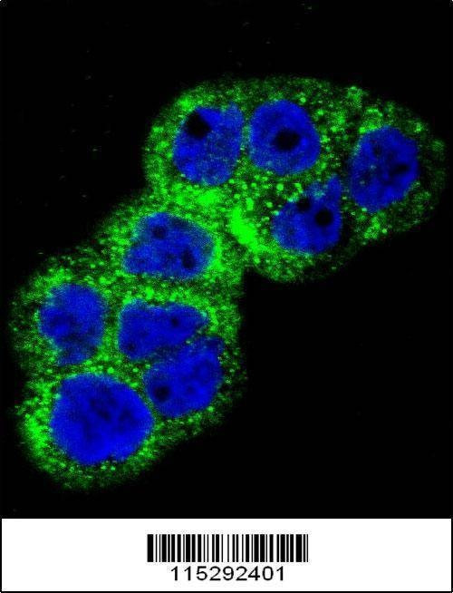 Anti-IGF1R (N-term K66) Antibody