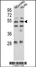 Anti-Sestrin-1 (C-term) Antibody