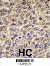 Anti-ILK (S246) Antibody