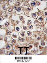 Anti-Insulin Receptor R (N-term) Antibody