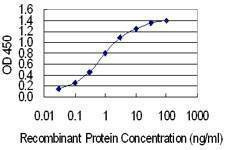 Anti-IRX1 Antibody