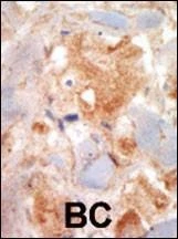 Anti-c-KIT (N-term) Antibody