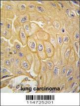 Anti-MCK10 Antibody