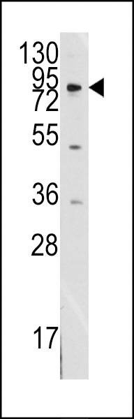 Anti-MCK10 Antibody