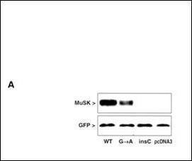 Anti-MUSK (N-term) Antibody