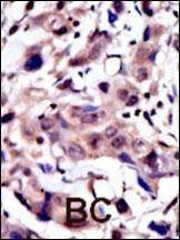 Anti-MUSK (N-term) Antibody