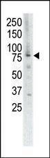 Anti-MUSK (C-term) Antibody