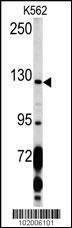 Anti-PDGFRA (C-term E1063) Antibody
