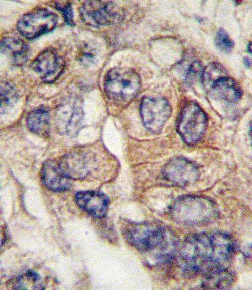 Anti-Mouse PDGFRA (Y720) Antibody