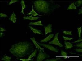Anti-ISCU Antibody