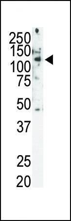 Anti-RET (C-term T1078) Antibody