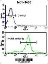 Anti-ROR1 Antibody
