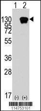 Anti-ROR1 Antibody