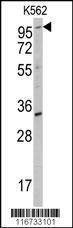 Anti-ROR2 Antibody