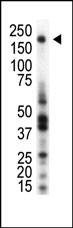 Anti-RON Antibody