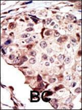 Anti-RYK Antibody