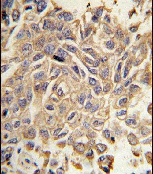 Anti-RYK Antibody