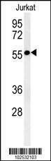 Anti-STK33 (C-term) Antibody