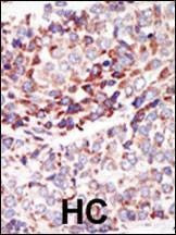 Anti-TEK (TIE2) (C-term) Antibody