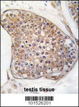 Anti-TEK (TIE2) (C-term) Antibody