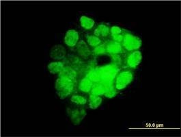 Anti-ITGB3BP Antibody