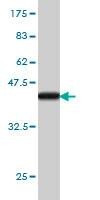 Anti-ITGB3BP Antibody