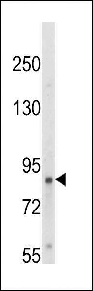 Anti-TrkA-pY791 Antibody