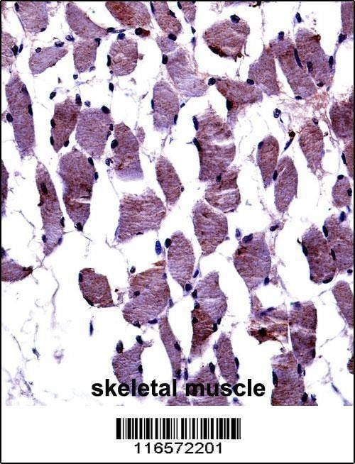 Anti-TrkA-pY791 Antibody