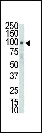 Anti-DDR2 (TYRO10) Antibody