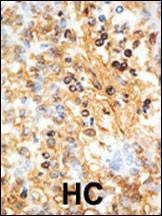 Anti-DOK1 (N-term) Antibody