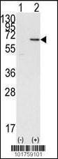 Anti-DOK1 (N-term) Antibody