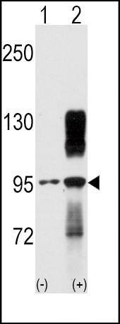 Anti-TYRO10 Antibody
