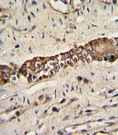 Anti-TYRO10 Antibody