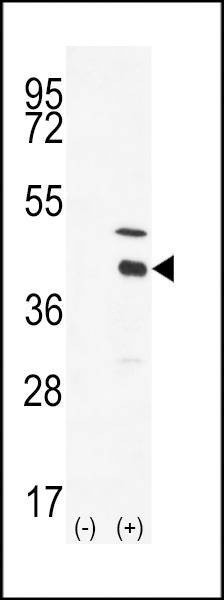 Anti-DOK4 (C-term) Antibody