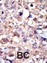 Anti-c ABL (ABL1) (C-term) Antibody