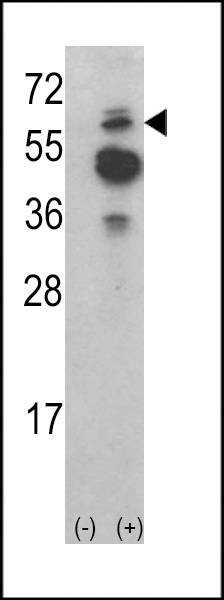 Anti-ACK1 (N-term) Antibody