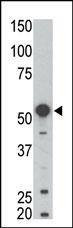 Anti-BLK (N-term) Antibody