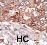 Anti-BLK (N-term) Antibody