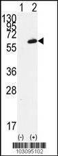 Anti-FGR (N-term) Antibody