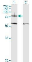 Anti-ITGB8 Antibody