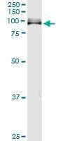 Anti-ITGB8 Antibody