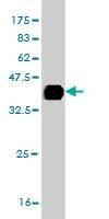 Anti-ITGB8 Antibody