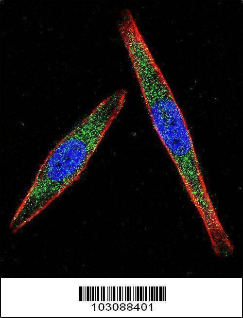 Anti-LCK (N-term) Antibody