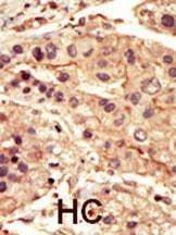Anti-SRMS (C-term) Antibody