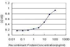 Anti-ITM1 Antibody
