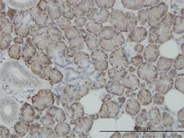 Anti-ITM1 Antibody