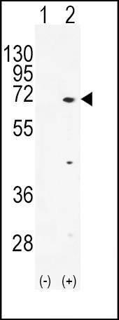 Anti-TXK (N-term) Antibody