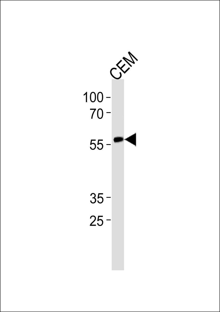 Anti-RUNX2 (S533) Antibody