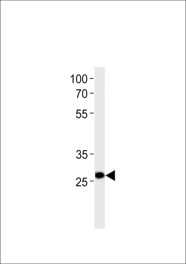 Anti-IPF (C-term) Antibody